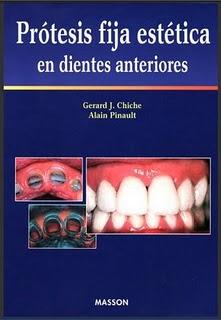 Protesis Fija Estetica En Dientes Anteriores de Gerard J. Chiche – Libro