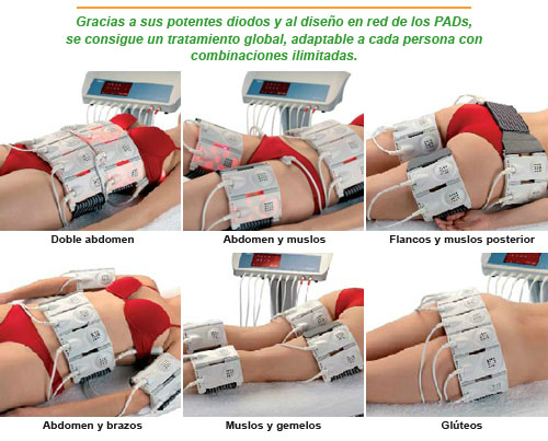 !! Lipobelt Laser !! Tratamiento Liporeductor Adelgazante 100% Efectivo