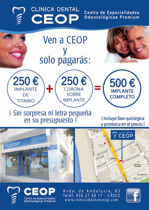 clinica dental CEOP ofrece implantes dentales a 250€