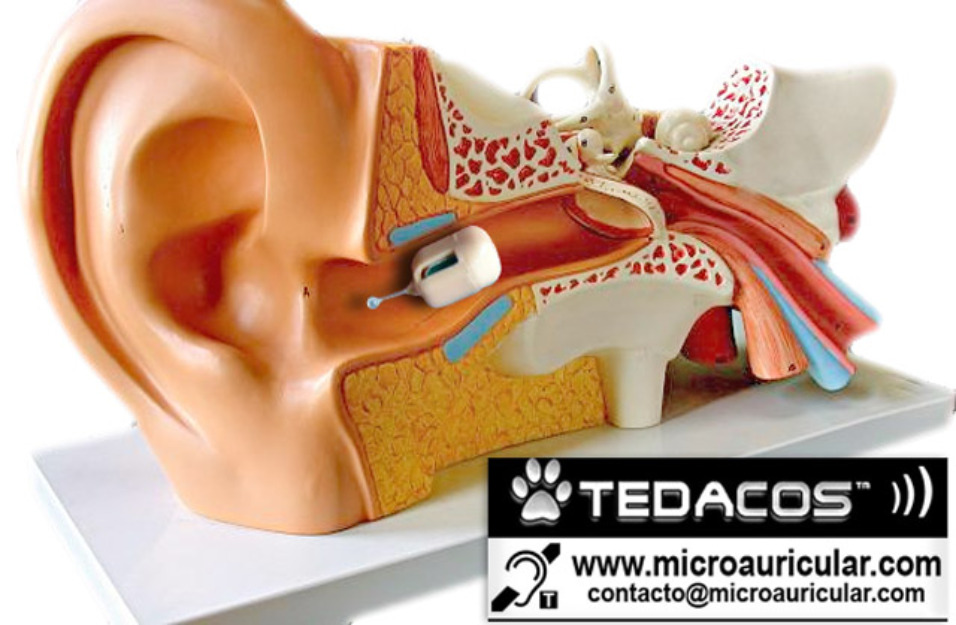 Intrauricular Inalambrico Apuntador Examen Máxima Calidad Sonido