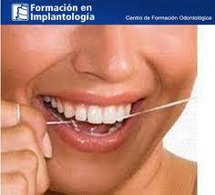 IMPLANTES DENTALES BARATOS A 250 EUROS